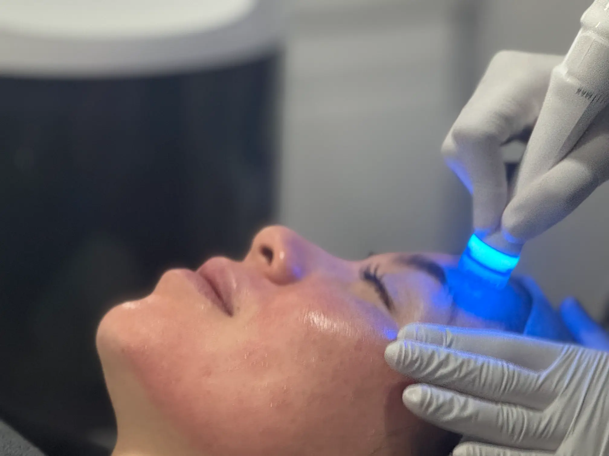 AquaPure Facial with Laser Toning