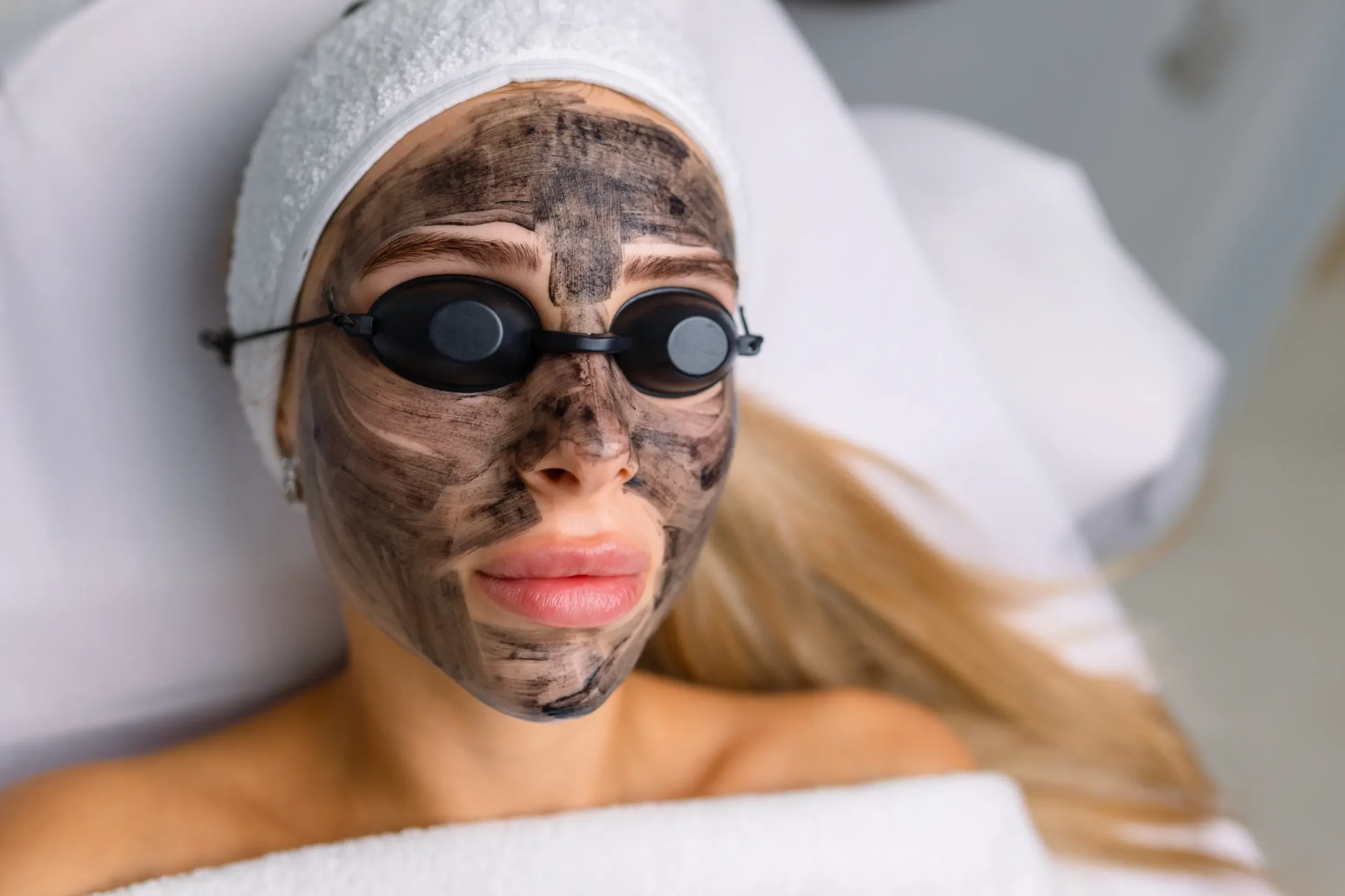 Woman prepared for a carbon laser peel with a carbon mask applied and protective goggles on.
