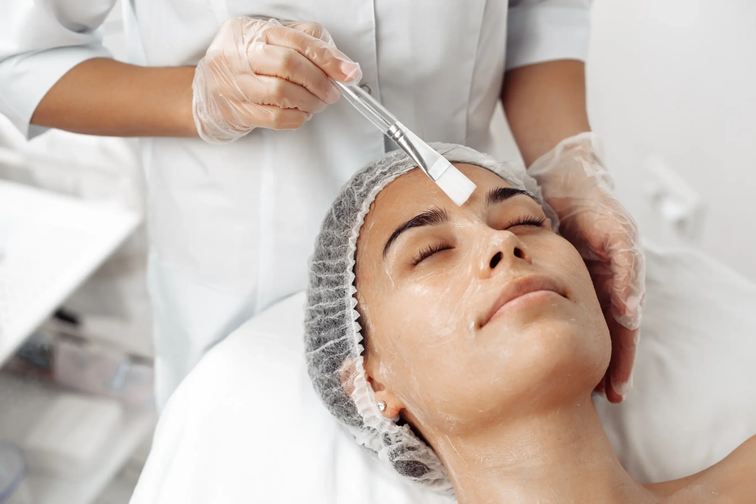 A client wearing a hair net and with eyes closed is receiving a chemical peel.