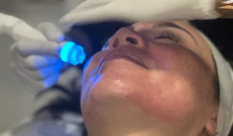 Close-up of a client receiving an AQUA PURE FACIAL, a skin-rejuvenating treatment that exfoliates, lifts, and infuses the skin with glow-boosting serums, administered by a gloved practitioner at La Maison Beauté.